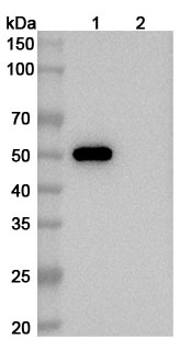 Human CD4 Monoclonal Antibody binds to Human CD4 Recombinant Protein, N-His in WB Assay