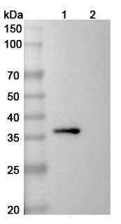 Human CD81 Monoclonal Antibody binds to Recombinant Mouse CD81 Protein, N-GST & C-His in WB Assay