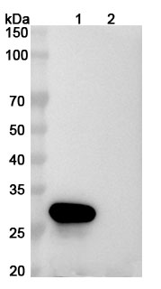 Mouse Anti-Human PMEL17/ME20M Antibody (17A9) binds to Recombinant Human PMEL Protein, N-His in WB Assay
