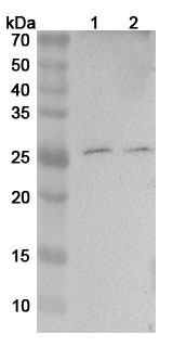 Mouse TNFa / TNF-alpha Polyclonal Antibody  binds to Human TNFa Recombinant Protein in WB Assay