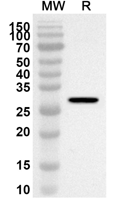 MPP2 Polyclonal Antibody  binds to MPP2, N-His, recombinant protein in WB Assay