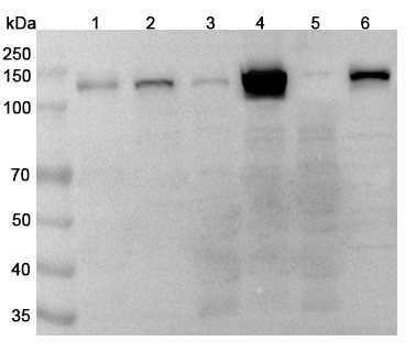 PARP1 Polyclonal Antibody  binds to Recombinant Human PARP1 Protein, N-His in WB Assay