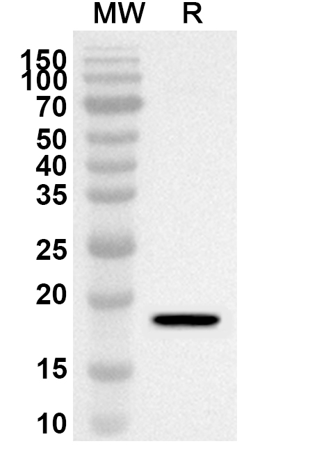 TNFa / TNF-alpha Polyclonal Antibody  binds to Human TNFa Recombinant Protein in WB Assay