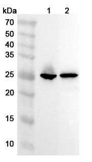 TNNI3 Polyclonal Antibody  binds to TNNI3, N-His, recombinant protein in WB Assay