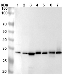 Anti-Human RPA2 Polyclonal Antibody binds to Recombinant Human RPA2 Protein, N-His in WB Assay