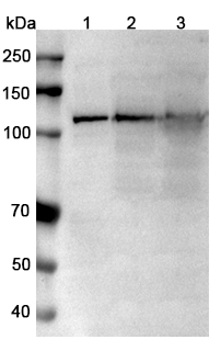 Anti-Human TRPM4/LTRPC4 Monoclonal Antibody, SAA0760 in WB Assay