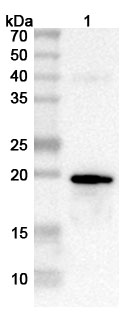 Anti-Pseudomonas aeruginosa PcrV Polyclonal Antibody binds to Recombinant Pseudomonas aeruginosa PcrV Protein, N-His in WB Assay