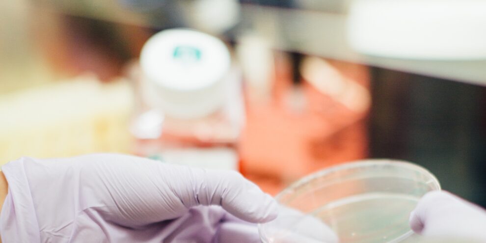 The benefits and limitations of using hybridoma technology to discover new antibodies