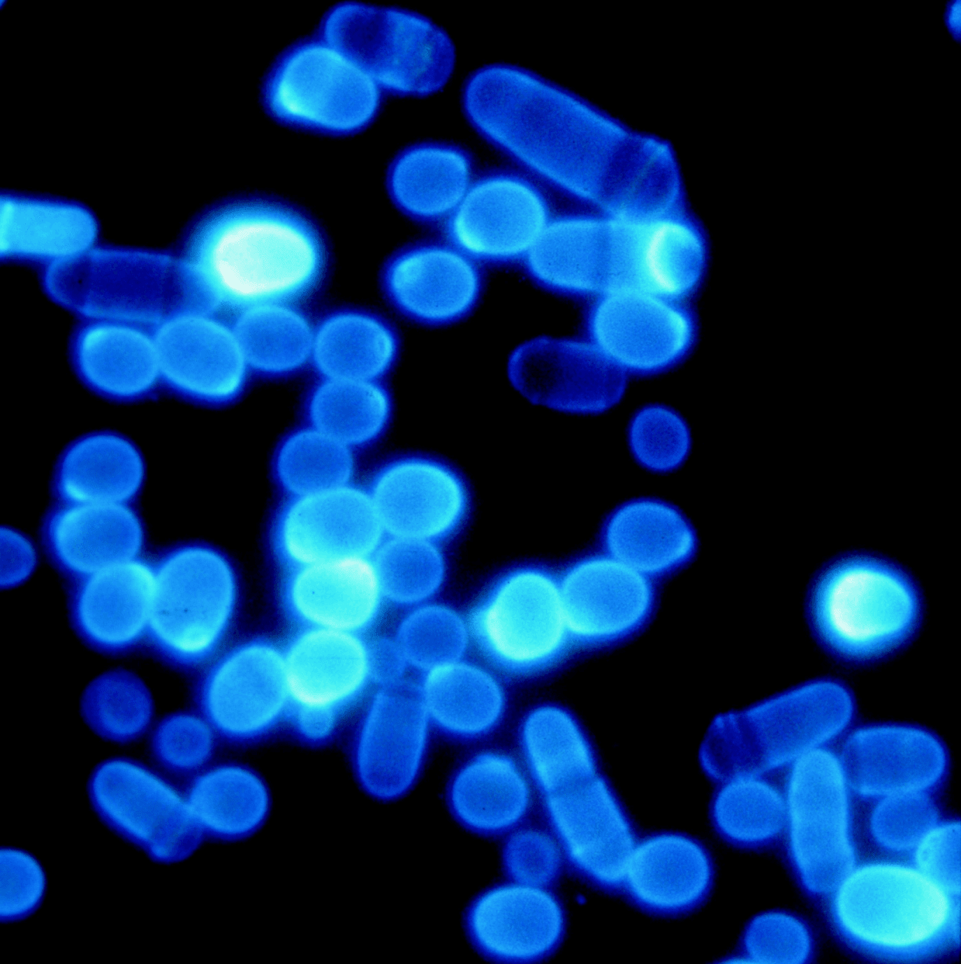 Polyclonal antibody purification