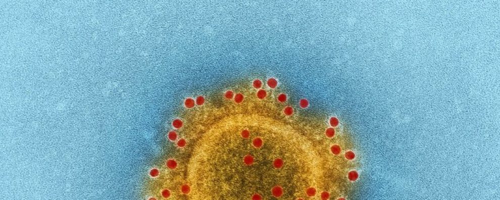 Novel Coronavirus 2019 – How to Mitigate the Impact of the New and Future Epidemics?