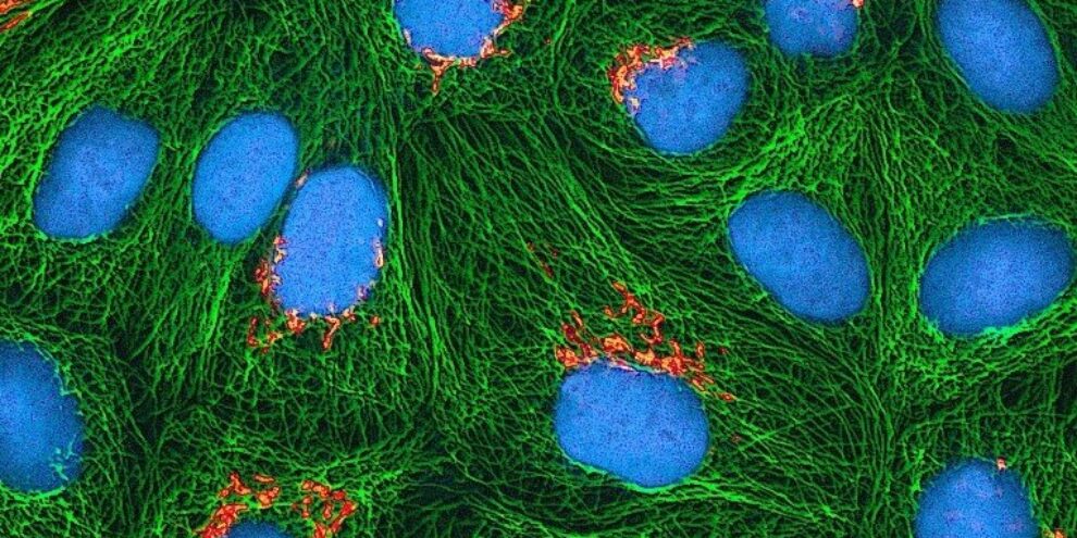Antibody production: hybridoma technology as the preferred method for therapeutic applications?