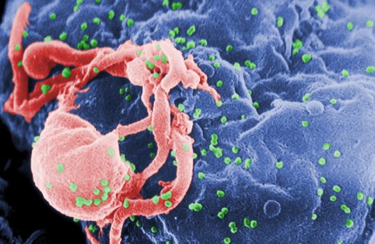 How is antibody therapy changing the way we treat HIV?