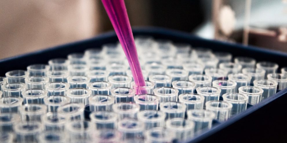 How to select the right antibody carrier for ADCs?