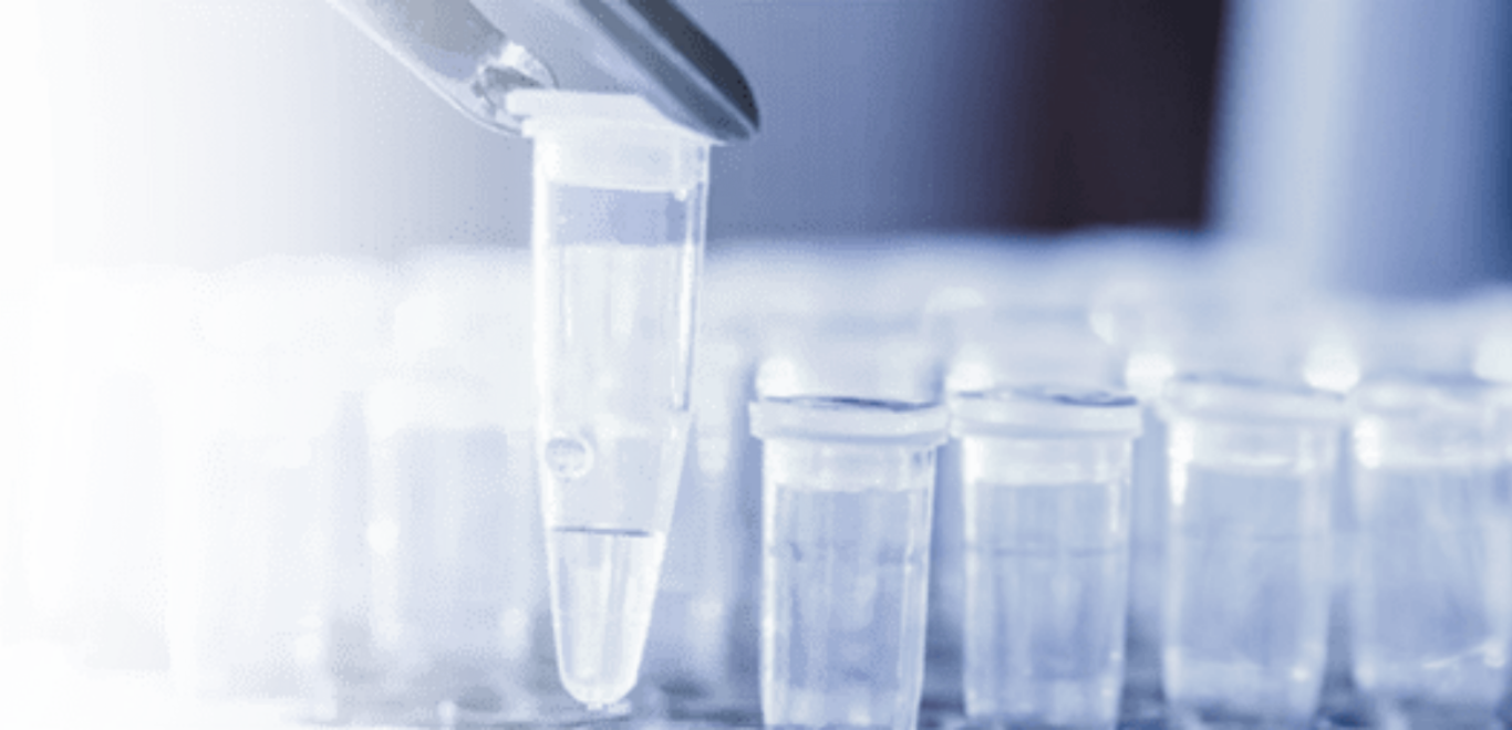 Tagged Protein Purification ProteoGenix