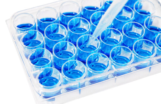 How To Improve The Yield Of Your Antibody Production?