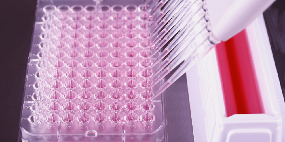 Top Tips for Extracting High-Performing Antibodies from Phage Display