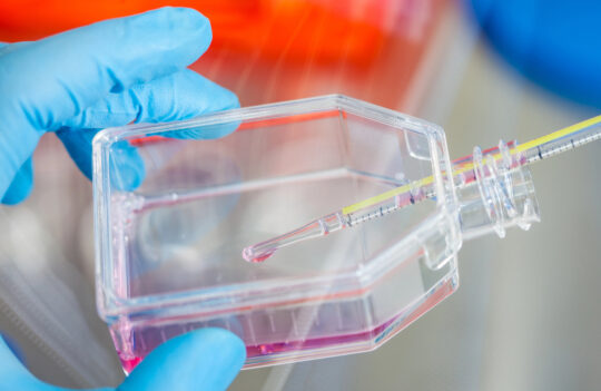 How to generate stable cell lines?