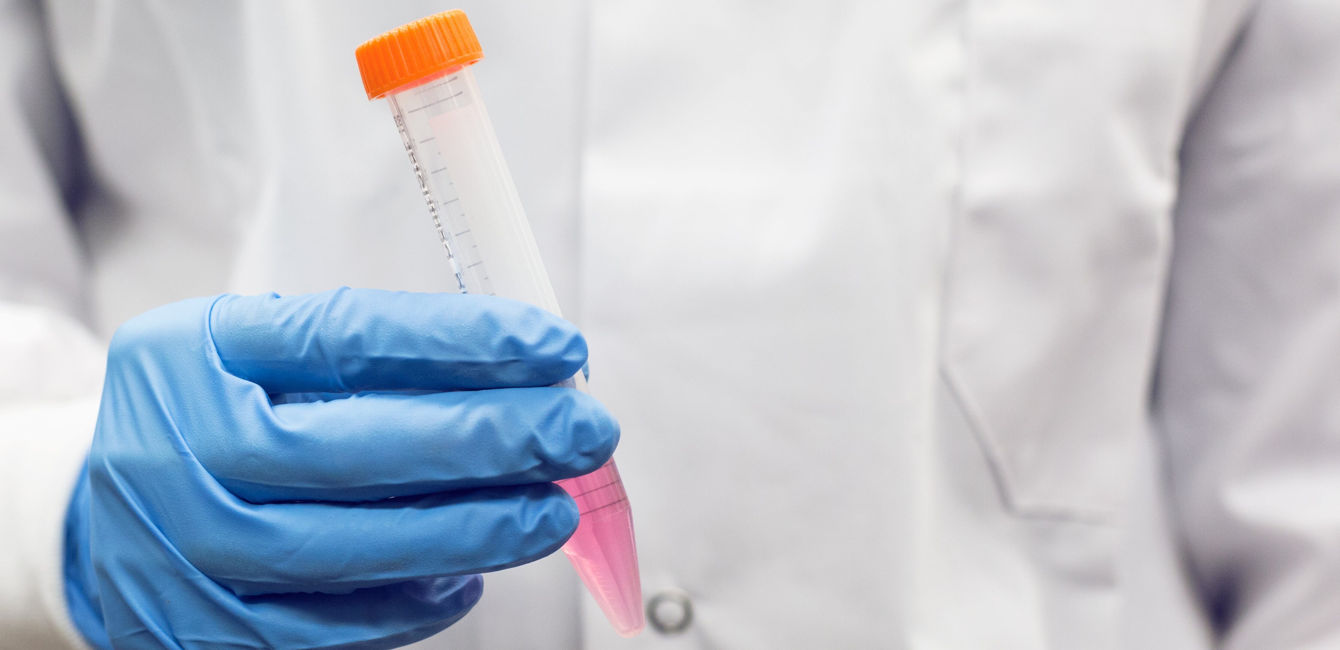 Strengthen Antibody Patents with our Epitope and Paratope Mapping service