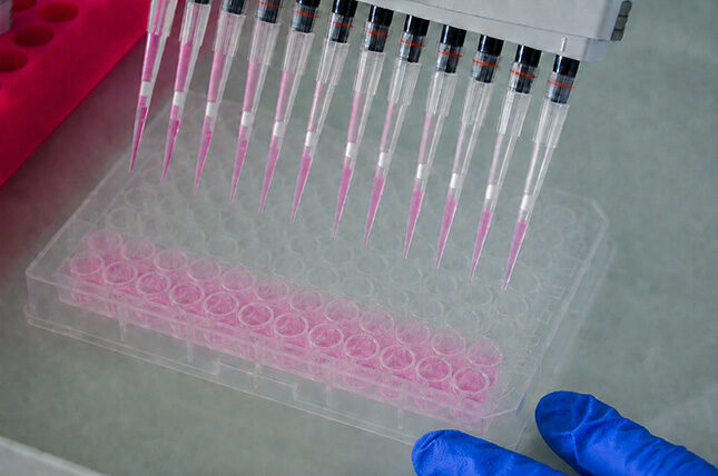 rabbit antibodies